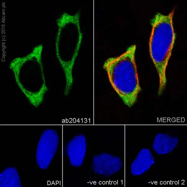 Immunocytochemistry/ Immunofluorescence - Anti-PFKM + PFKP antibody [EPR17314] (AB204131)