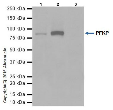 Immunoprecipitation - Anti-PFKM + PFKP antibody [EPR17314] (ab204131), expandable thumbnail