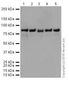 Western blot - Anti-PFKM + PFKP antibody [EPR17314] (AB204131)