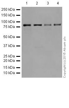 Western blot - Anti-PFKM + PFKP antibody [EPR17314] (AB204131), expandable thumbnail