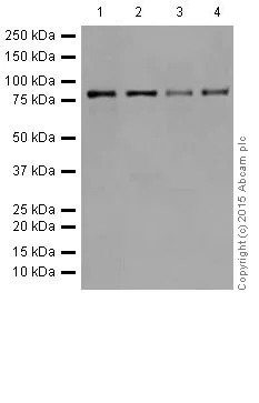 Western blot - Anti-PFKM + PFKP antibody [EPR17314] (AB204131)