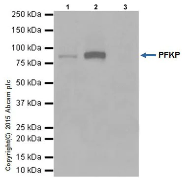 Immunoprecipitation - Anti-PFKM + PFKP antibody [EPR17314] - BSA and Azide free (AB242413)