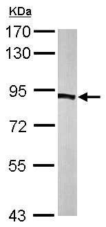 Western blot - Anti-PFKP antibody (AB137636)