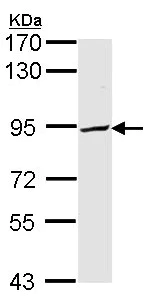 Western blot - Anti-PFKP antibody (AB137636)