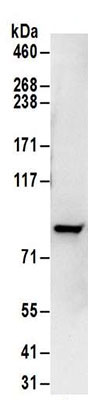 Immunoprecipitation - Anti-PFKP antibody (AB186132)