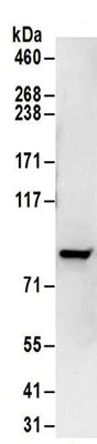 Immunoprecipitation - Anti-PFKP antibody (AB186132)