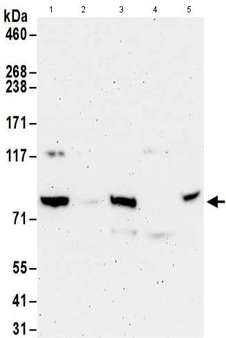 Western blot - Anti-PFKP antibody (AB186132)