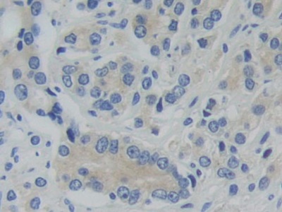 Immunohistochemistry (Formalin/PFA-fixed paraffin-embedded sections) - Anti-PFKP antibody (AB233109)