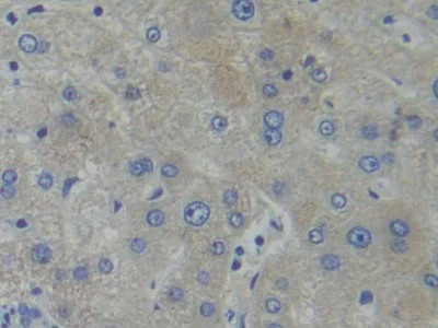 Immunohistochemistry (Formalin/PFA-fixed paraffin-embedded sections) - Anti-PFKP antibody (AB233109)