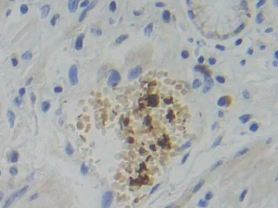 Immunohistochemistry (Formalin/PFA-fixed paraffin-embedded sections) - Anti-PFKP antibody (AB233109)