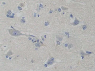 Immunohistochemistry (Formalin/PFA-fixed paraffin-embedded sections) - Anti-PFKP antibody (AB233109)