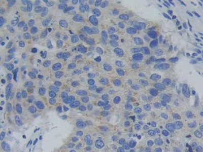 Immunohistochemistry (Formalin/PFA-fixed paraffin-embedded sections) - Anti-PFKP antibody (AB233109)