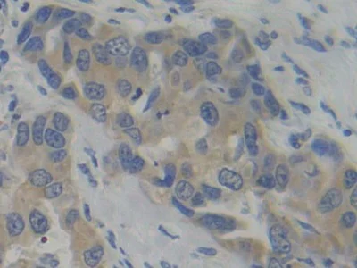 Immunohistochemistry (Formalin/PFA-fixed paraffin-embedded sections) - Anti-PFKP antibody (AB233109)