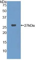 Western blot - Anti-PFKP antibody (AB233109)