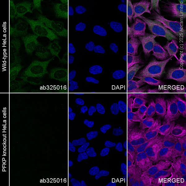 Immunocytochemistry/ Immunofluorescence - Anti-PFKP antibody [EPR28830-157] (AB325016)