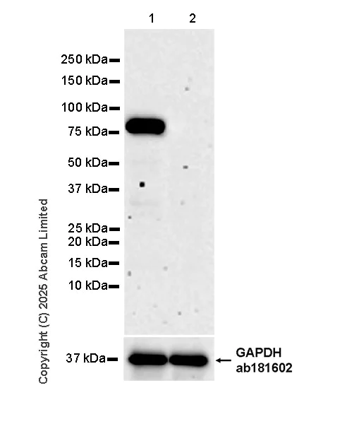 Western blot - Anti-PFKP antibody [EPR28830-157] (AB325016)