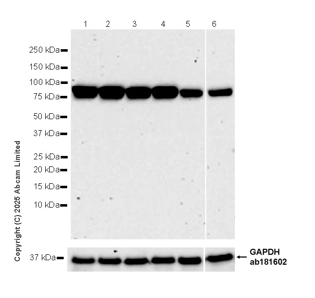 Western blot - Anti-PFKP antibody [EPR28830-157] (AB325016)