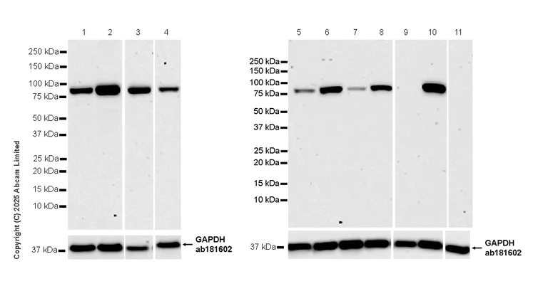 Western blot - Anti-PFKP antibody [EPR28830-157] (AB325016)