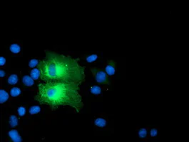 Immunocytochemistry/ Immunofluorescence - Anti-PFKP antibody [OTI1D6] (AB119796)