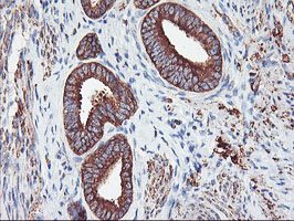 Immunohistochemistry (Formalin/PFA-fixed paraffin-embedded sections) - Anti-PFKP antibody [OTI1D6] (AB119796)