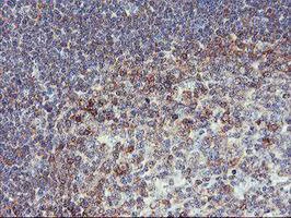 Immunohistochemistry (Formalin/PFA-fixed paraffin-embedded sections) - Anti-PFKP antibody [OTI1D6] (AB119796)