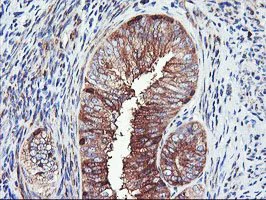 Immunohistochemistry (Formalin/PFA-fixed paraffin-embedded sections) - Anti-PFKP antibody [OTI1D6] (AB119796)