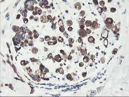 Immunohistochemistry (Formalin/PFA-fixed paraffin-embedded sections) - Anti-PFKP antibody [OTI1D6] (AB119796)