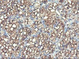 Immunohistochemistry (Formalin/PFA-fixed paraffin-embedded sections) - Anti-PFKP antibody [OTI1D6] (AB119796)