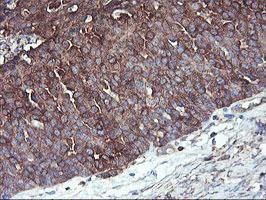 Immunohistochemistry (Formalin/PFA-fixed paraffin-embedded sections) - Anti-PFKP antibody [OTI1D6] (AB119796)