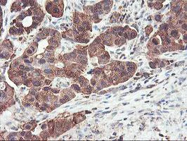 Immunohistochemistry (Formalin/PFA-fixed paraffin-embedded sections) - Anti-PFKP antibody [OTI1D6] (AB119796)