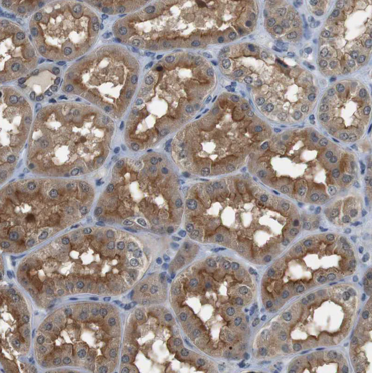 Immunohistochemistry (Formalin/PFA-fixed paraffin-embedded sections) - Anti-PFTK1 antibody (AB224098)