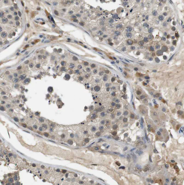 Immunohistochemistry (Formalin/PFA-fixed paraffin-embedded sections) - Anti-PFTK1 antibody (AB224098)