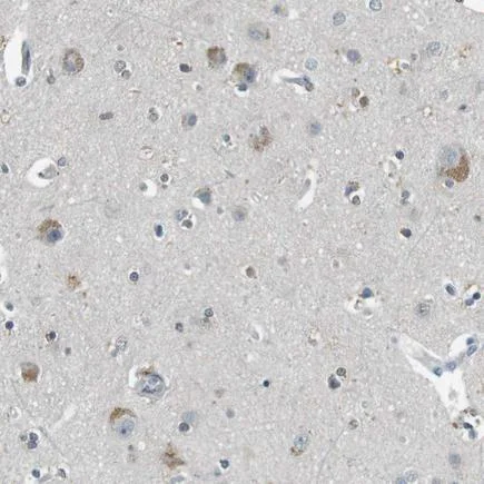 Immunohistochemistry (Formalin/PFA-fixed paraffin-embedded sections) - Anti-PFTK1 antibody (AB224098)