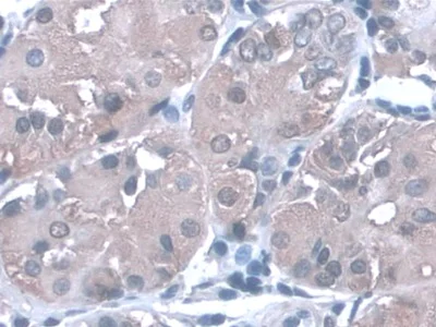 Immunohistochemistry (Formalin/PFA-fixed paraffin-embedded sections) - Anti-PGA5 antibody [C4] (AB239479)