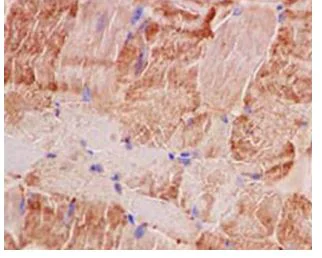 Immunohistochemistry (Formalin/PFA-fixed paraffin-embedded sections) - Anti-PGAM2 antibody [EPR15193(B)] (AB183027)