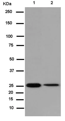 Western blot - Anti-PGAM2 antibody [EPR15193(B)] (AB183027)