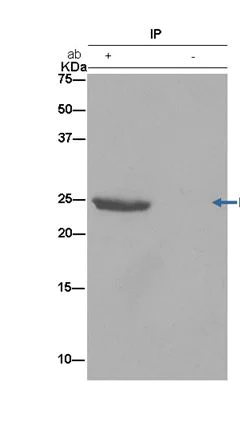 Immunoprecipitation - Anti-PGAM2 antibody [EPR15193(B)] - BSA and Azide free (AB250643)