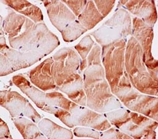 Immunohistochemistry (Formalin/PFA-fixed paraffin-embedded sections) - Anti-PGAM2 antibody [EPR15194(B)] (AB187147)