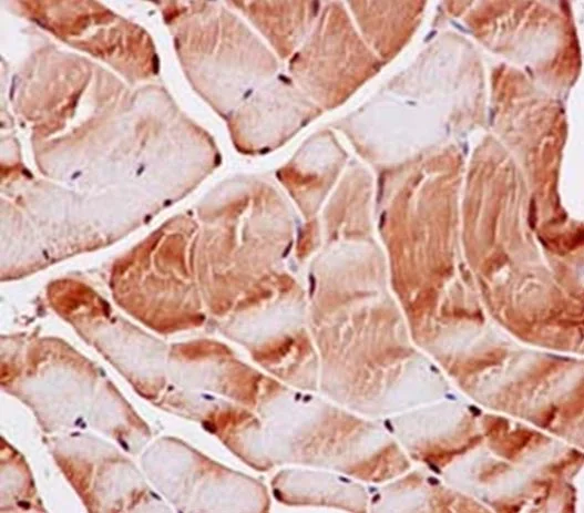 Immunohistochemistry (Formalin/PFA-fixed paraffin-embedded sections) - Anti-PGAM2 antibody [EPR15194(B)] (AB187147)