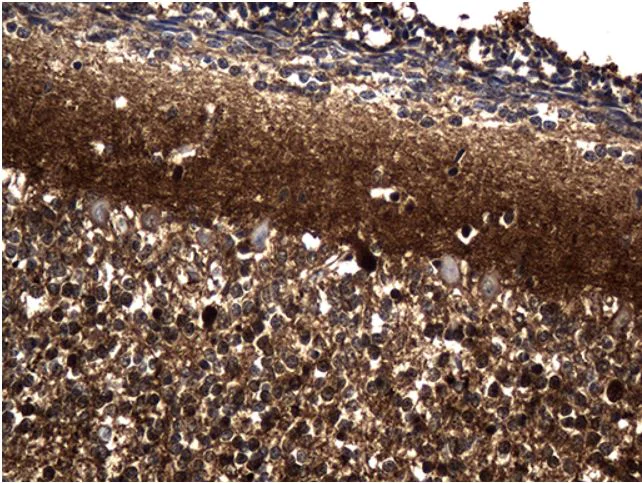 Immunohistochemistry (Formalin/PFA-fixed paraffin-embedded sections) - Anti-PGAM4 + PGAM1 antibody [OTI2A12] (AB279384)