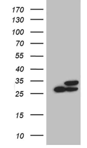 Western blot - Anti-PGAM4 + PGAM1 antibody [OTI2A12] (AB279384)