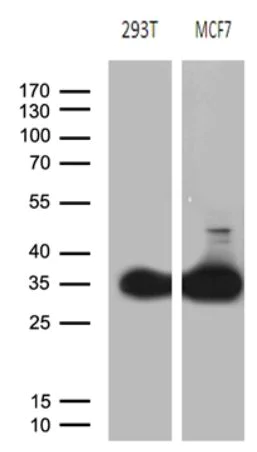 Western blot - Anti-PGAM4 + PGAM1 antibody [OTI2A12] (AB279384)