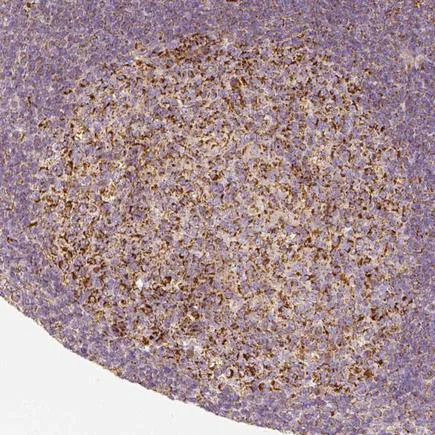 Immunohistochemistry (Formalin/PFA-fixed paraffin-embedded sections) - Anti-PGAM5 antibody (AB126534)