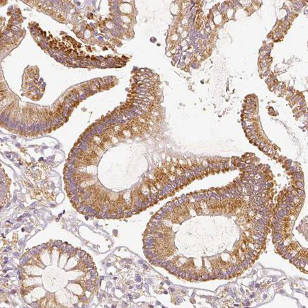 Immunohistochemistry (Formalin/PFA-fixed paraffin-embedded sections) - Anti-PGAM5 antibody (AB126534)