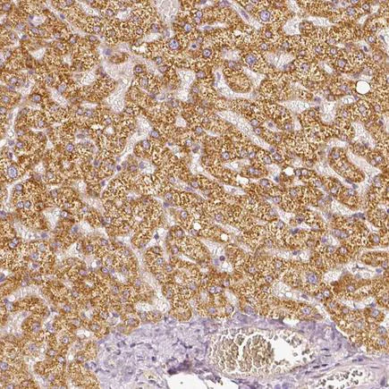 Immunohistochemistry (Formalin/PFA-fixed paraffin-embedded sections) - Anti-PGAM5 antibody (AB126534)