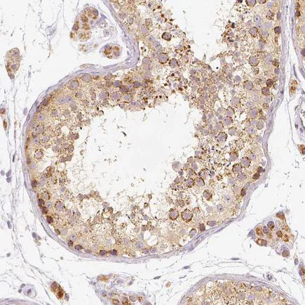 Immunohistochemistry (Formalin/PFA-fixed paraffin-embedded sections) - Anti-PGAM5 antibody (AB126534)