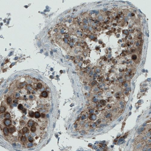 Immunohistochemistry (Formalin/PFA-fixed paraffin-embedded sections) - Anti-PGAM5 antibody [CL0624] (AB244218), expandable thumbnail