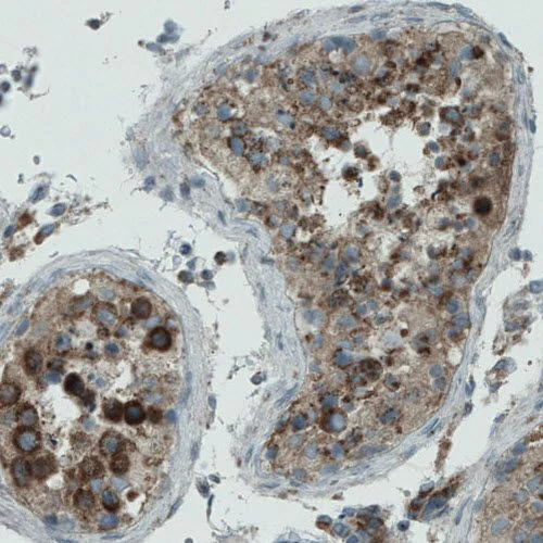 Immunohistochemistry (Formalin/PFA-fixed paraffin-embedded sections) - Anti-PGAM5 antibody [CL0624] (AB244218)