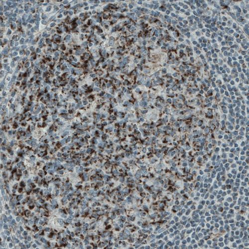 Immunohistochemistry (Formalin/PFA-fixed paraffin-embedded sections) - Anti-PGAM5 antibody [CL0624] (AB244218), expandable thumbnail
