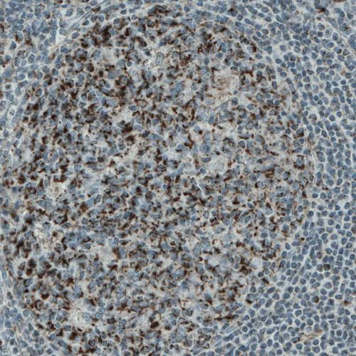 Immunohistochemistry (Formalin/PFA-fixed paraffin-embedded sections) - Anti-PGAM5 antibody [CL0624] (AB244218)